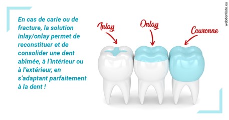 https://dr-cohen-guedj-sophie.chirurgiens-dentistes.fr/L'INLAY ou l'ONLAY