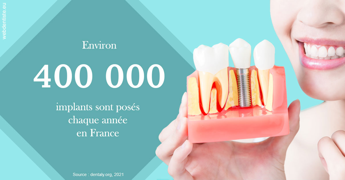 https://dr-cohen-guedj-sophie.chirurgiens-dentistes.fr/Pose d'implants en France 2