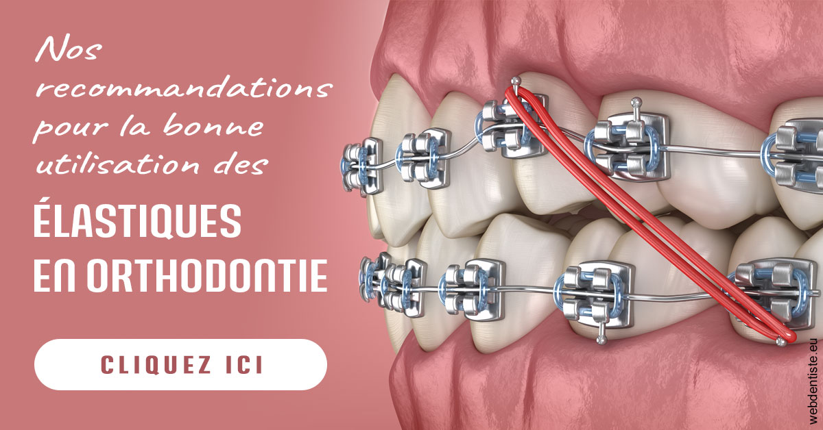 https://dr-cohen-guedj-sophie.chirurgiens-dentistes.fr/Elastiques orthodontie 2